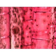 LEVENHUK  ΠΑΡΑΣΚΕΥΑΣΜΑΤΑ ΣΕΤ 10τμχ | Αξεσουάρ για Μικροσκόπια στο smart-tech.gr